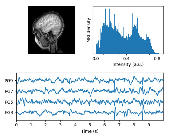 ../../_images/mri_with_eeg.png