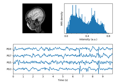 ../_images/sphx_glr_mri_with_eeg_thumb.png