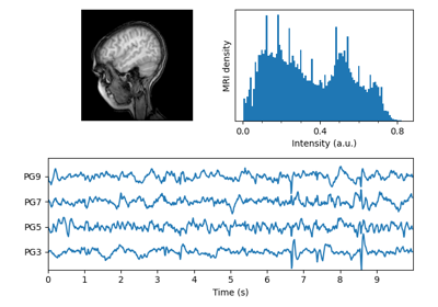 ../../_images/sphx_glr_mri_with_eeg_thumb.png