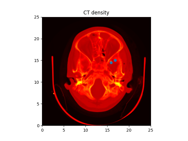 CT density